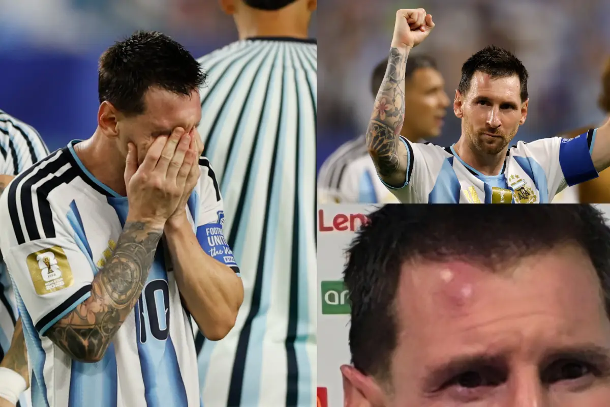 Lionel Messi terminó con un chichón tras el partido entre Argentina vs. Cabo Verde 