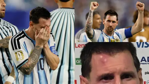 ¿Qué le pasó a Messi? Leo reveló un detalle que pasó desapercibido