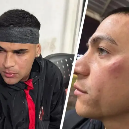 Tensión en el fútbol argentino: jugadores fueron agredidos tras un partido - RR.SS.