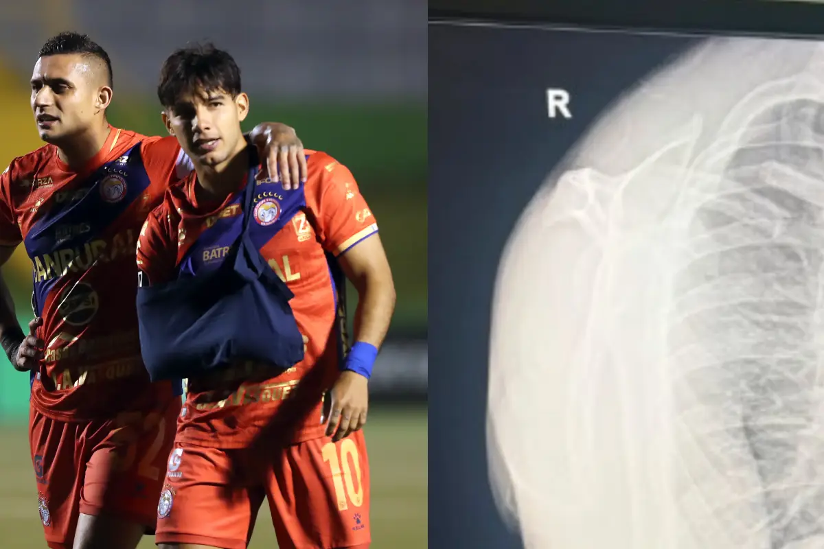 Jesús López sufrió una lesión en el hombro derecho durante el partido ante Firpo 