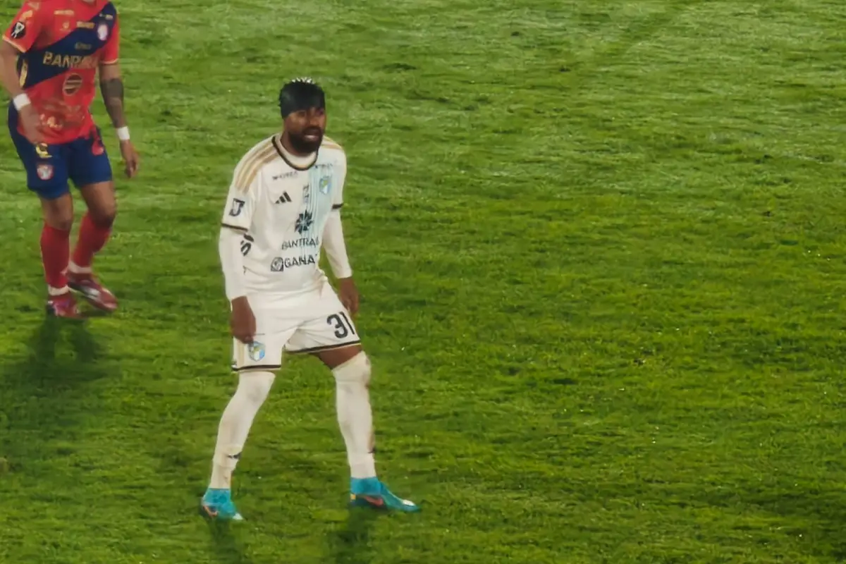 Dewinder Bradley terminó con un golpe en la victoria de Comunicaciones ante Xelajú - Willber Colloy