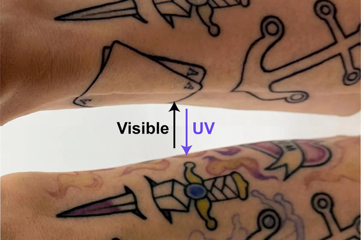 Tatuaje en el brazo antes y después de la activación con luz,  Crédito: Matter 