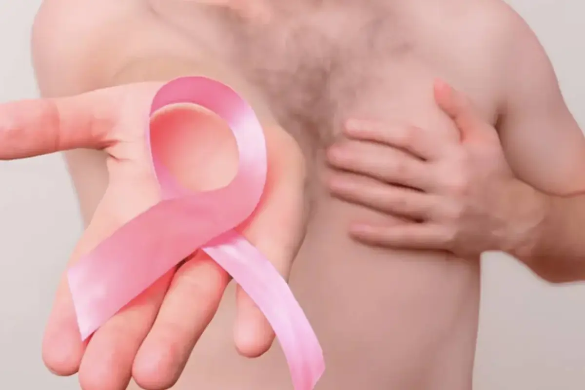 Cáncer de mama, Cáncer de mama