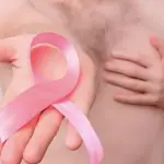 Cáncer de mama ,Cáncer de mama