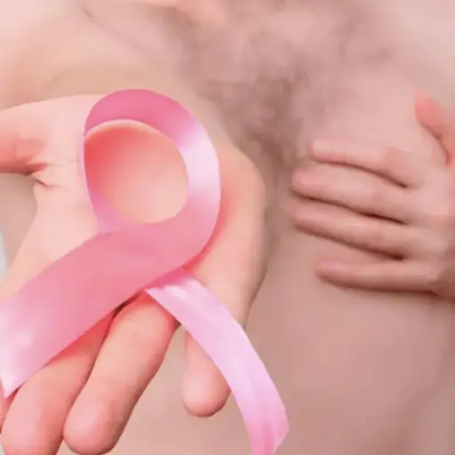 Cáncer de mama ,Cáncer de mama